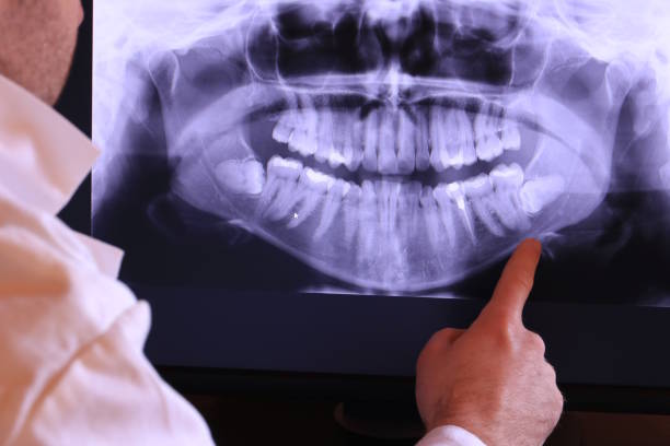 Best Emergency Dentist for Knocked-Out Tooth in Valley Cottage, NY
