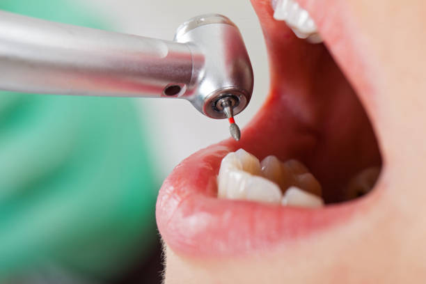 Best Urgent Dental Care for Toothache in Valley Cottage, NY